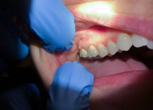 Best Orthodontic Emergency Dentist in Spring Lake, NC