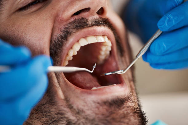 Best Orthodontic Emergency Dentist in Spring Lake, NC